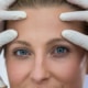 Close-up of a woman’s face with gloved hands gently lifting her forehead and brow area, demonstrating the effect of a temporal brow lift