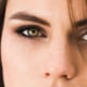 Close-up of a woman’s green eyes and under eye area, illustrating natural results of lower blepharoplasty