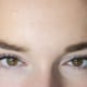 A close up of the eyes after a brow lift, showing no hooding and a more open upper eyelid area.