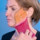 Dr. Richard Balikian demonstrating platysma muscle anatomy and jowl formation on a patient model while explaining deep plane facelift and neck lift surgery