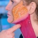 Illustration of the platysma muscle showing how neck bands form and affect jawline and neck contour