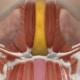 Deep neck structures beneath the jawline including submandibular glands and digastric muscles shown in anatomical illustration of submental fullness