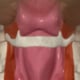 Anatomical illustration of the hyoid bone beneath the jaw showing its position within the deep neck and relationship to surrounding muscles and structural support of the neckline