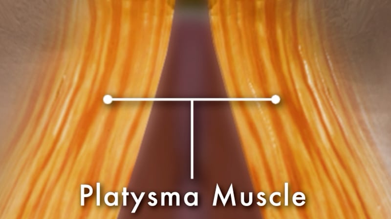 Platysma muscle of the neck shown in anatomical illustration, highlighting its role in neck contour and formation of neck bands with aging