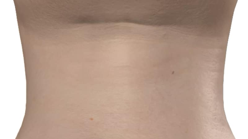 Surface view of the neck highlighting the outer skin layer and natural contour.