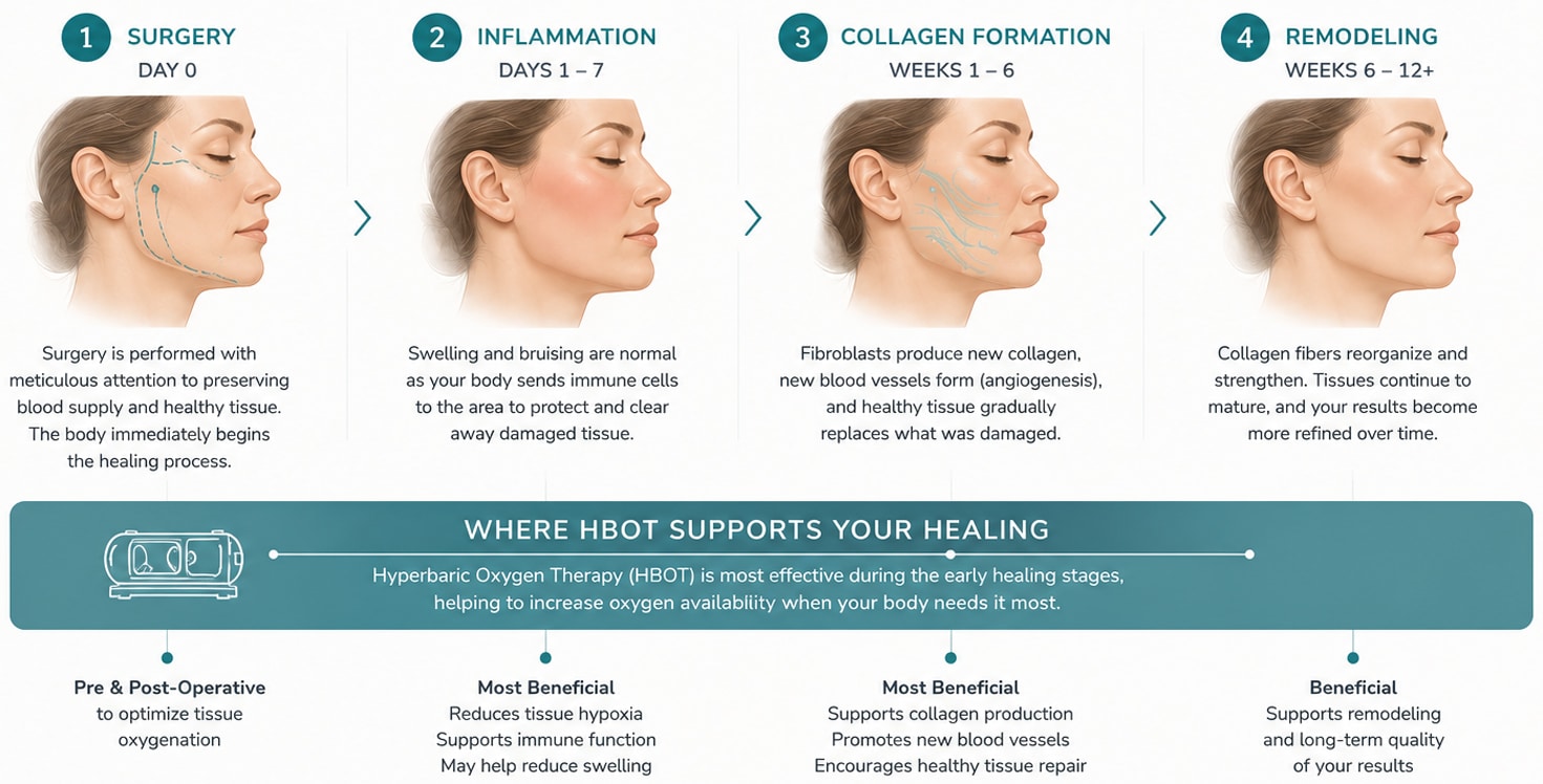 Illustrated healing timeline after facial plastic surgery showing the four stages of recovery—surgery, inflammation, collagen formation, and remodeling—and where Hyperbaric Oxygen Therapy (HBOT) may support tissue oxygenation and healing.